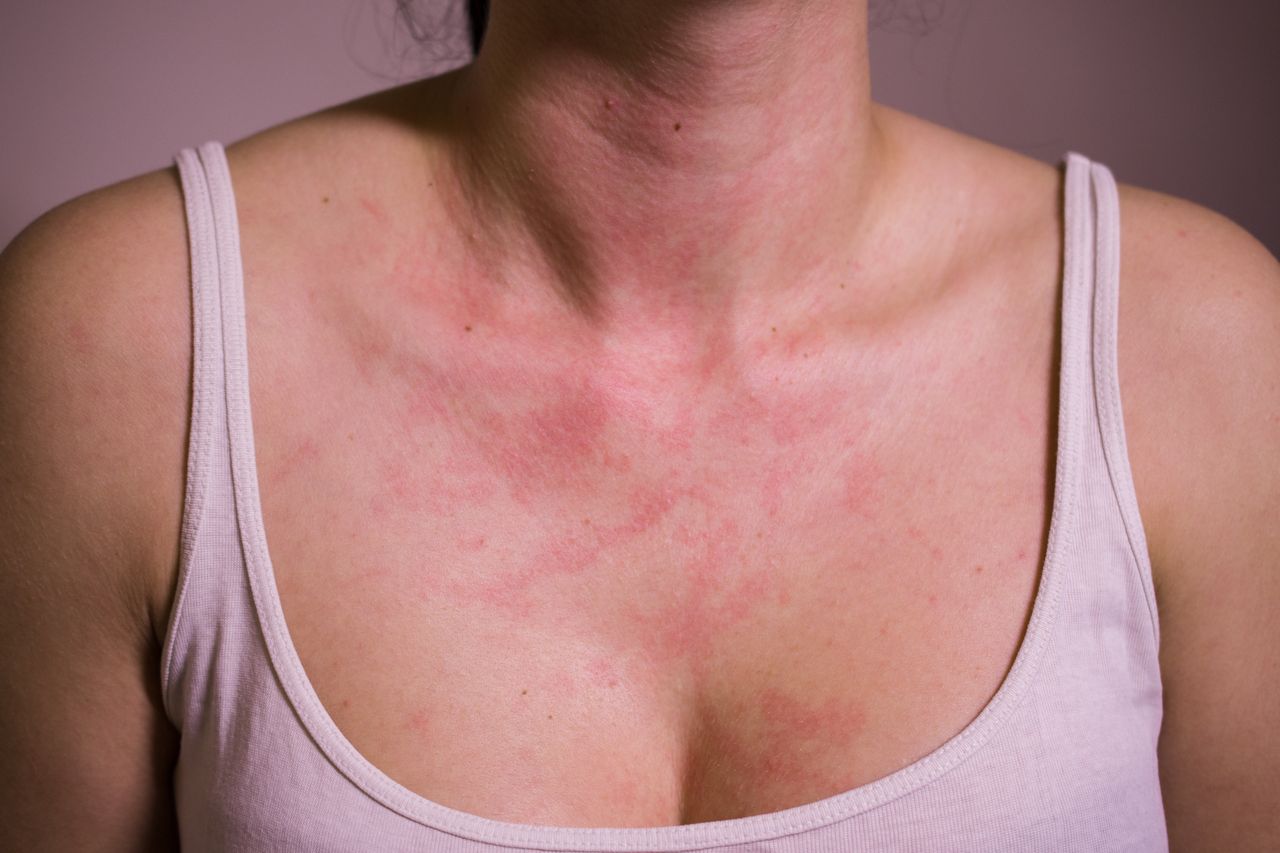 Skin spots: When discolorations hint at serious health risks