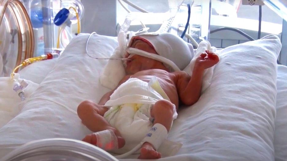 Urodziła się w 23.tyg ciąży