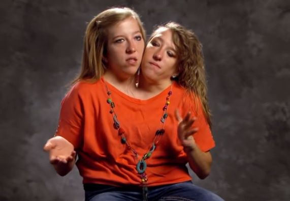 Abby and Brittany Hensel