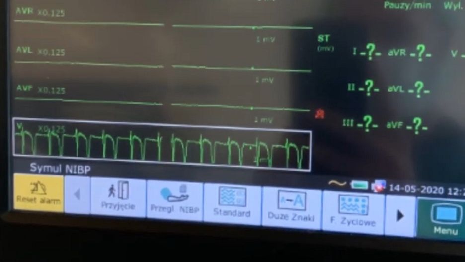 Sonda służy do odczytywania sygnału EKG bezpośrednio z powierzchni serca