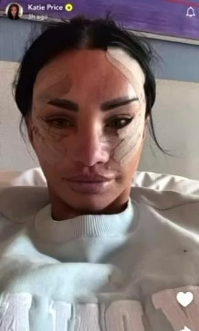 Katie Price wspomina poprzednie operacje w Turcji