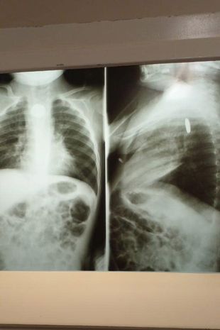 Lekarze prześwietlili chłopca 