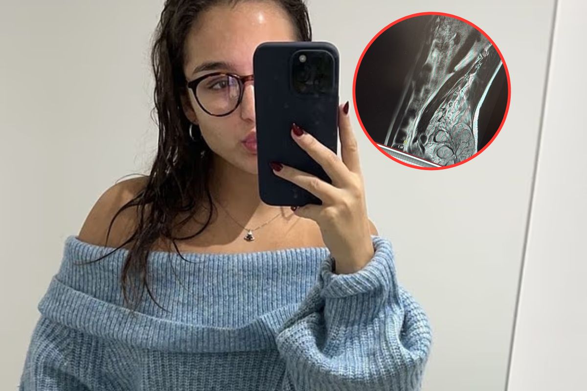 Guz był wielkości grejpfruta. Lekarze pomylili raka z rwą kulszową