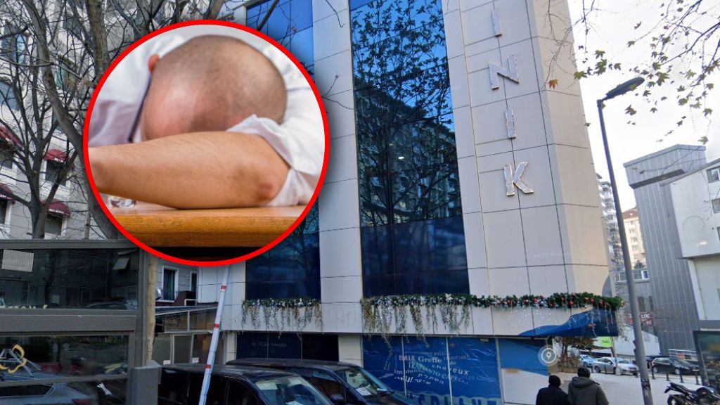 Tragiczny finał przeszczepu włosów  w Turcji