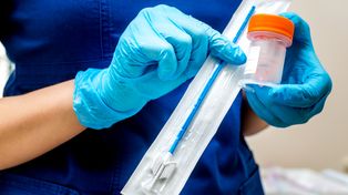 Koniec cytologii na NFZ. Zmiany już od 1 sierpnia