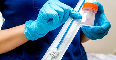 Koniec cytologii na NFZ. Zmiany już od 1 sierpnia