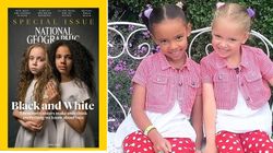 Co słychać u tych nietypowych bliźniaczek? Siostry o różnych kolorach skóry