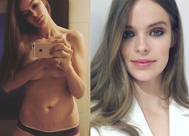 Robyn Lawley o rozstępach: "Pier... innych i bądź sobą!"