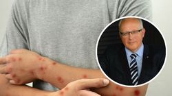 Nadciąga zmutowany wirus. "Nie zamkniemy przecież granic"