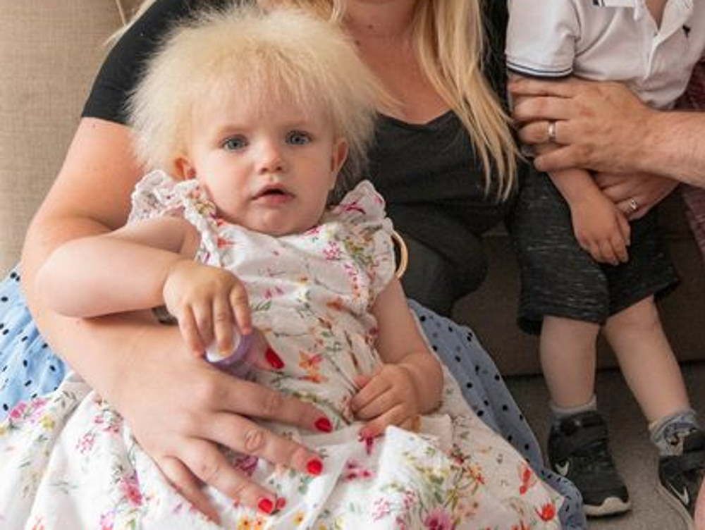 Dziewczynka cierpi na rzadką przypadłość