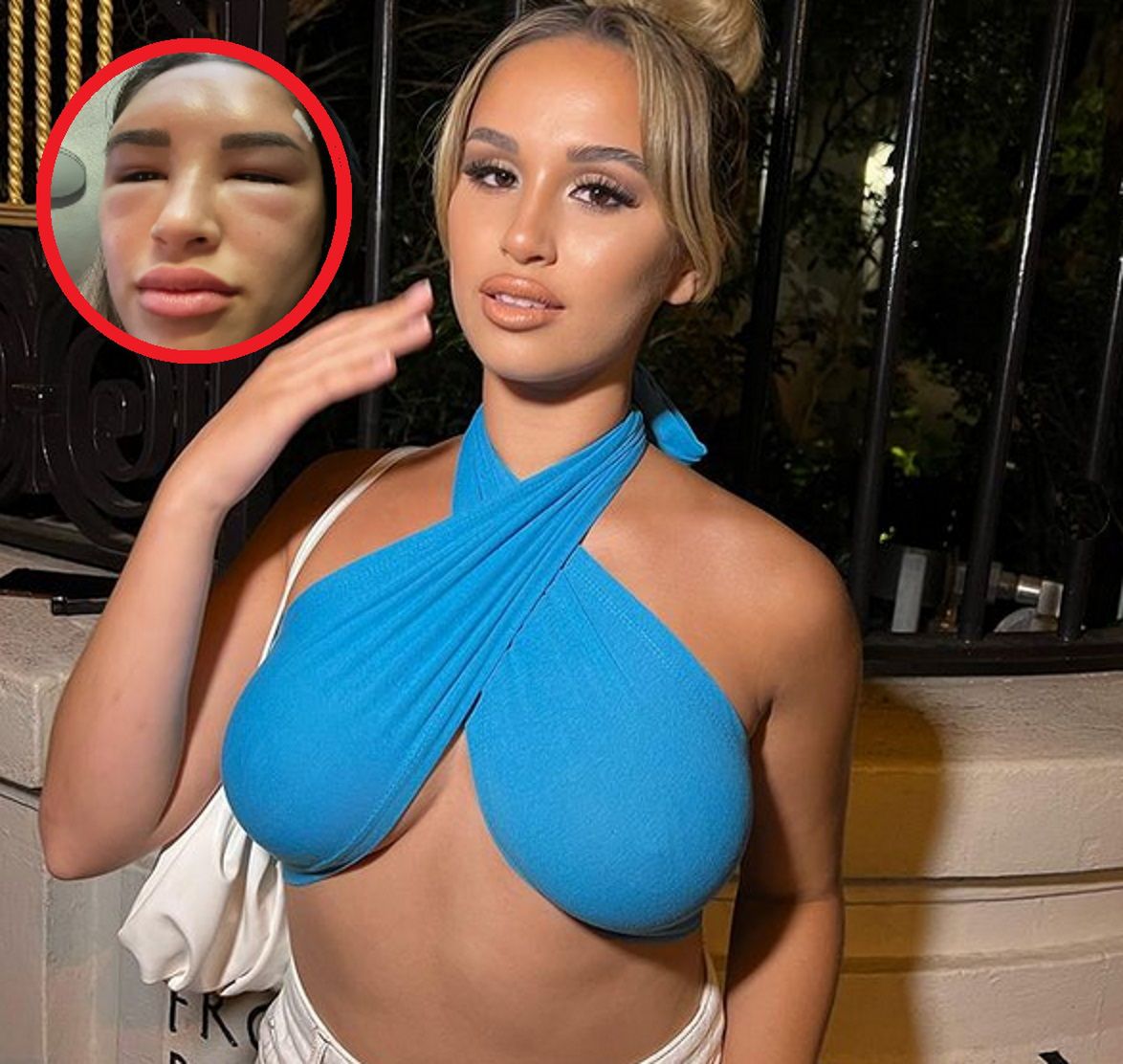 Mówi, że wyglądała jak "kosmitka z rogami". Wszystko przez pewien zabieg