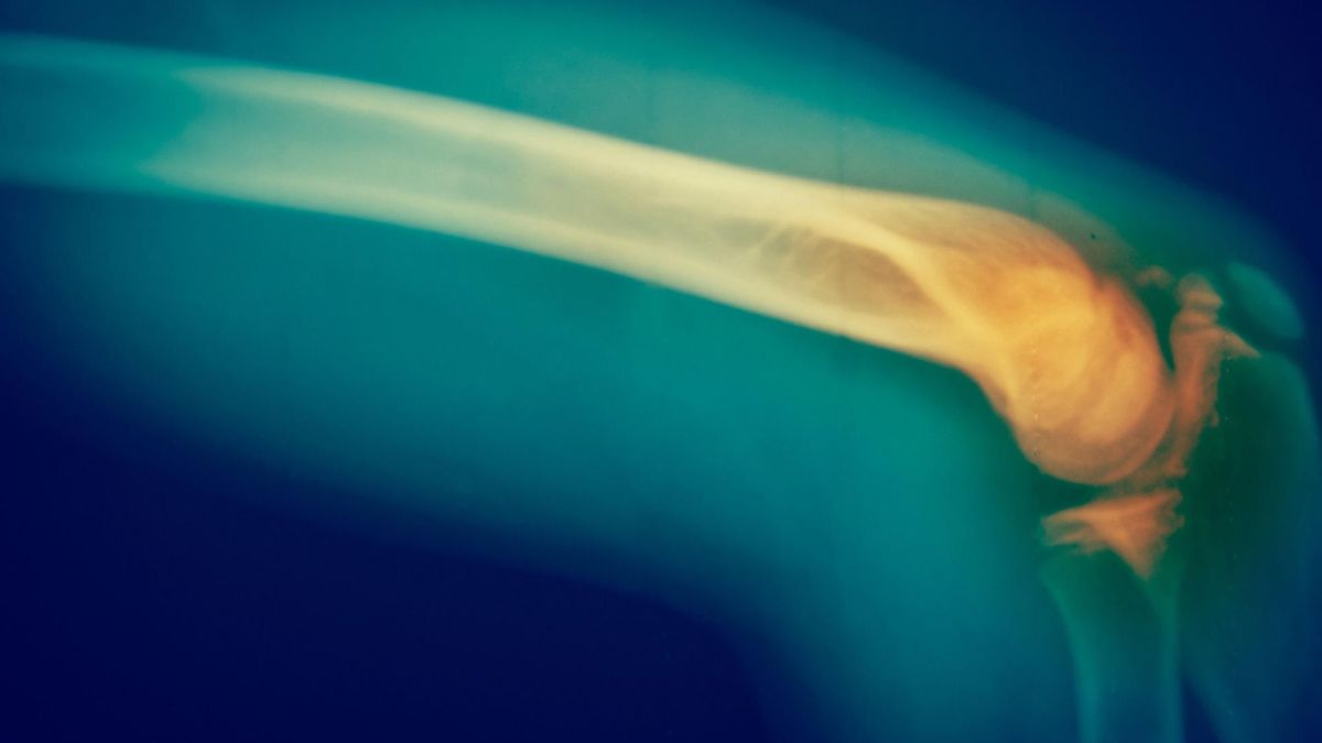 Słuchaj, co mówi twój organizm