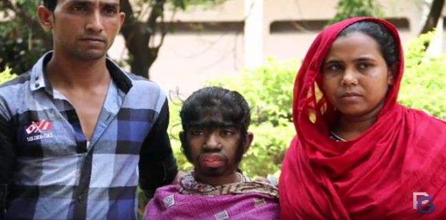 Bithi Akhtar cierpi na 