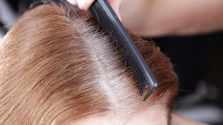 Występuje w warzywach. Może zapobiegać siwieniu włosów