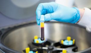 Wrocław: pokonała koronawirusa – teraz odda krew