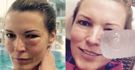 "Celebrity Splash": Felicjańska już podbiła sobie oko...