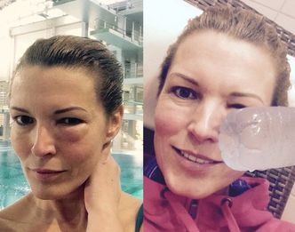 "Celebrity Splash": Felicjańska już podbiła sobie oko...