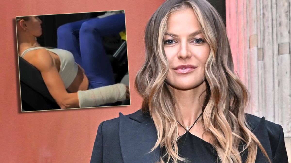 Anna Lewandowska z opatrunkiem