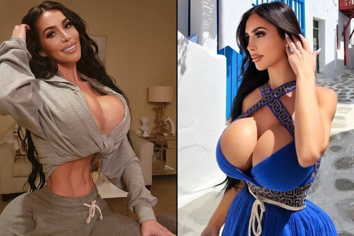 Chciała wyglądać jak Kim Kardashian. Zmarła na skutek operacji plastycznej