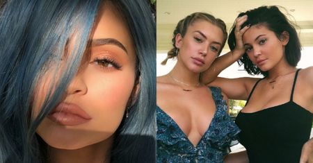 Szokujące wyznanie Kylie Jenner: "Pozbyłam się WYPEŁNIACZY Z UST!"