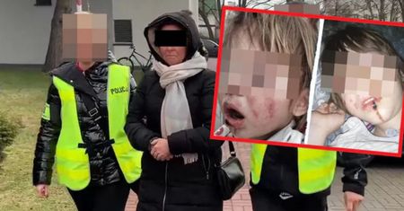 Matka z piekła rodem. Oszpecała córkę substancją żrącą. Jest akt oskarżenia