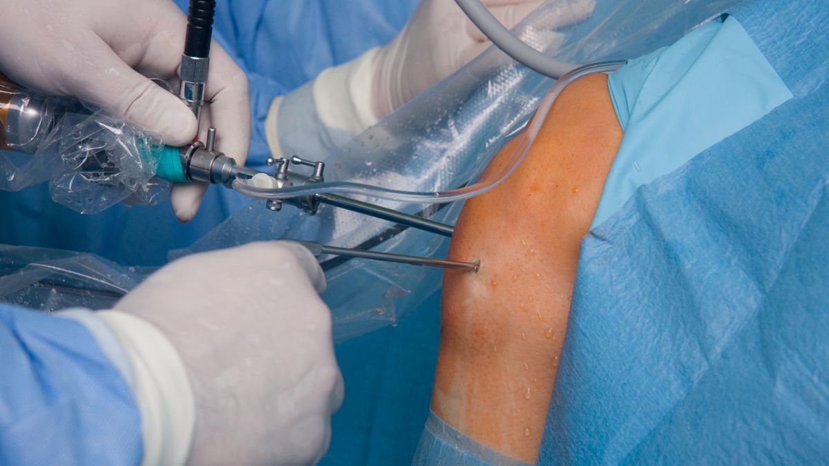 Rekonstrukcja więzadła krzyżowego przedniego kolana zalecana jest nie tylko zawodowym sportowcom, ale również amatorom, mającym zamiar powrócić do uprawiania ukochanego sportu.