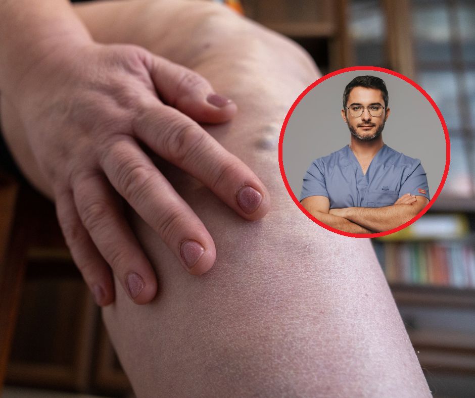 Wystarczy jeden czynnik, by aktywować zakrzepicę. Lekarz mówi, kiedy ryzyko jest największe