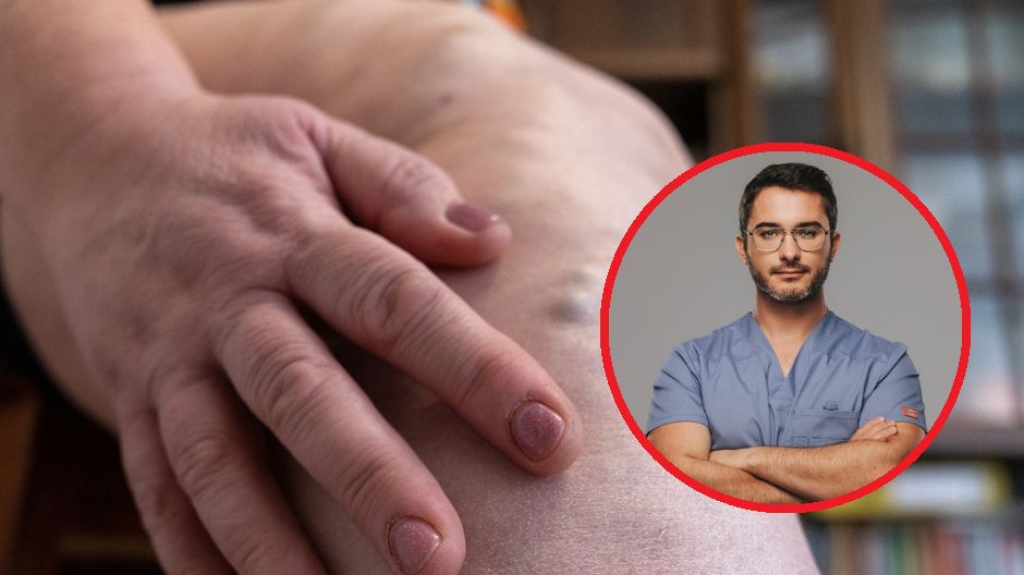 Przed lotem warto zadbać o profilaktykę zakrzepowo-zatorową