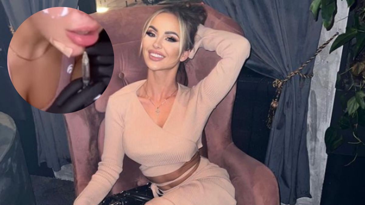 Julia Skrodzka postanowiła powiększyć usta. Nie udała się jednak do profesjonalisty