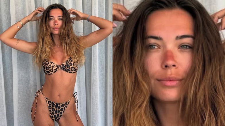 Sandra Kubicka ze spalonym nosem