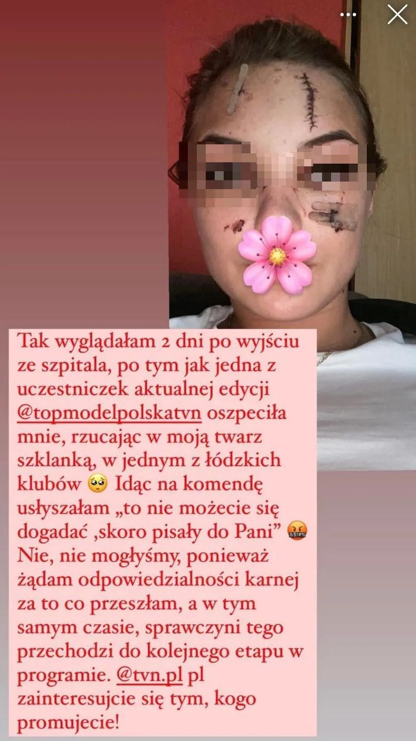Uczestniczka "Top Model" odpowiada na zarzuty Internautki