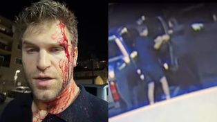 Ujawniono nagranie z telefonu ALARMOWEGO po krwawym ataku na Keegana Allena. Gwiazdor "Słodkich kłamstewek" został brutalnie pobity