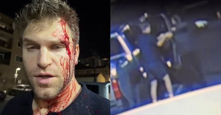 Ujawniono nagranie z telefonu ALARMOWEGO po krwawym ataku na Keegana Allena. Gwiazdor "Słodkich kłamstewek" został brutalnie pobity