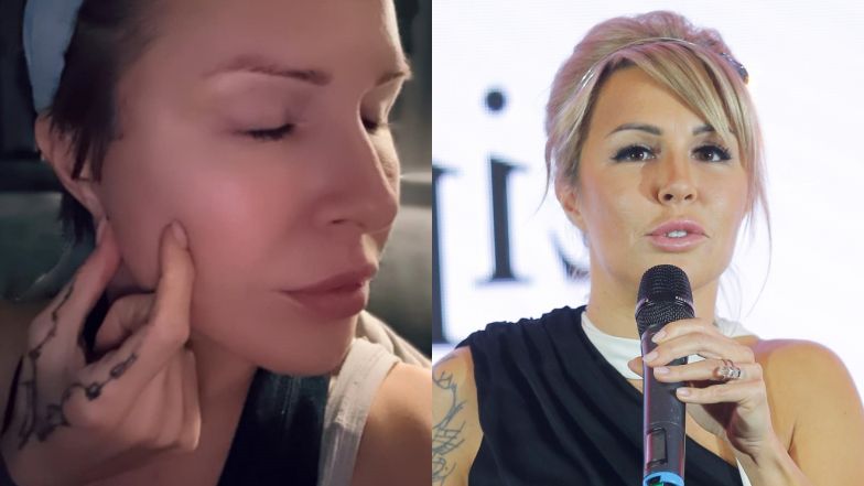 Blanka Lipińska żali się na lifting twarzy