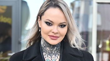 Z taką chorobą musi mierzyć się Monika Miller. Pewne objawy była zmuszona UKRYWAĆ