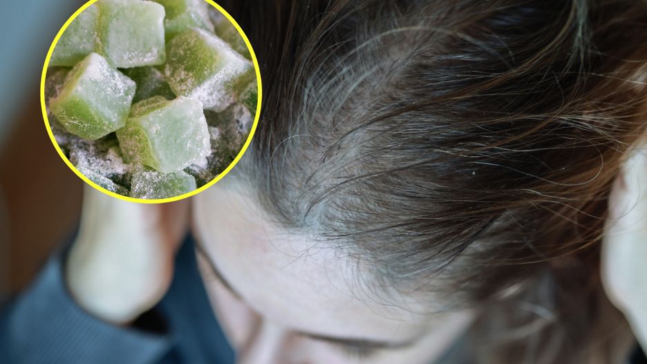 Słodycze i przetworzone jedzenie mogą nasilać wypadanie włosów