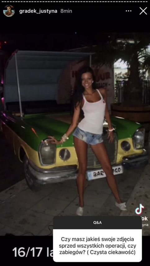 Tak Justyna Gradek wyglądała przed operacjami plastycznymi