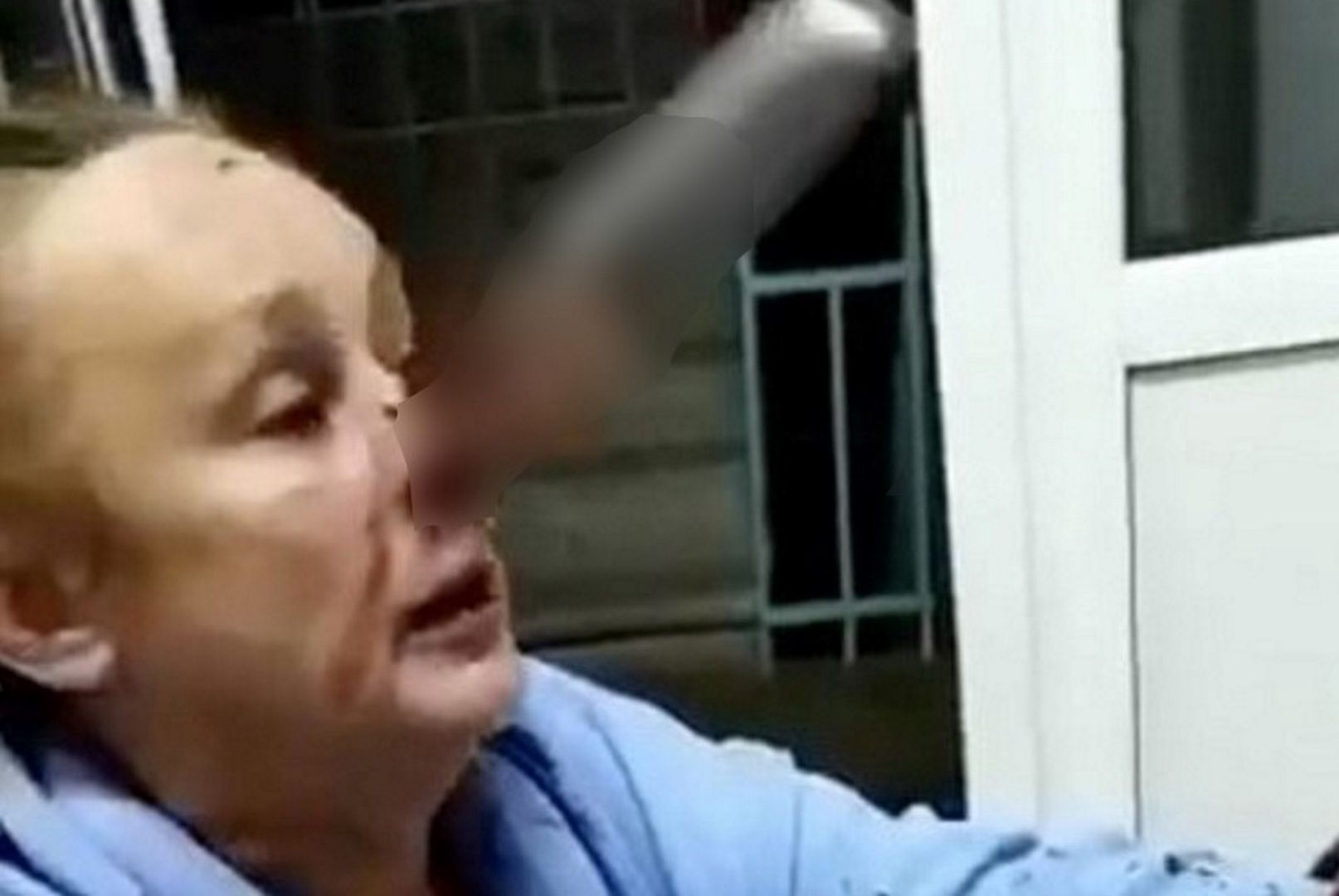 Rosjanka może mówić o cudzie. 25-centymetrowy nóż wbił jej się w nos