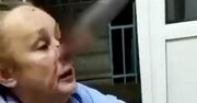 Rosjanka może mówić o cudzie. 25-centymetrowy nóż wbił jej się w nos