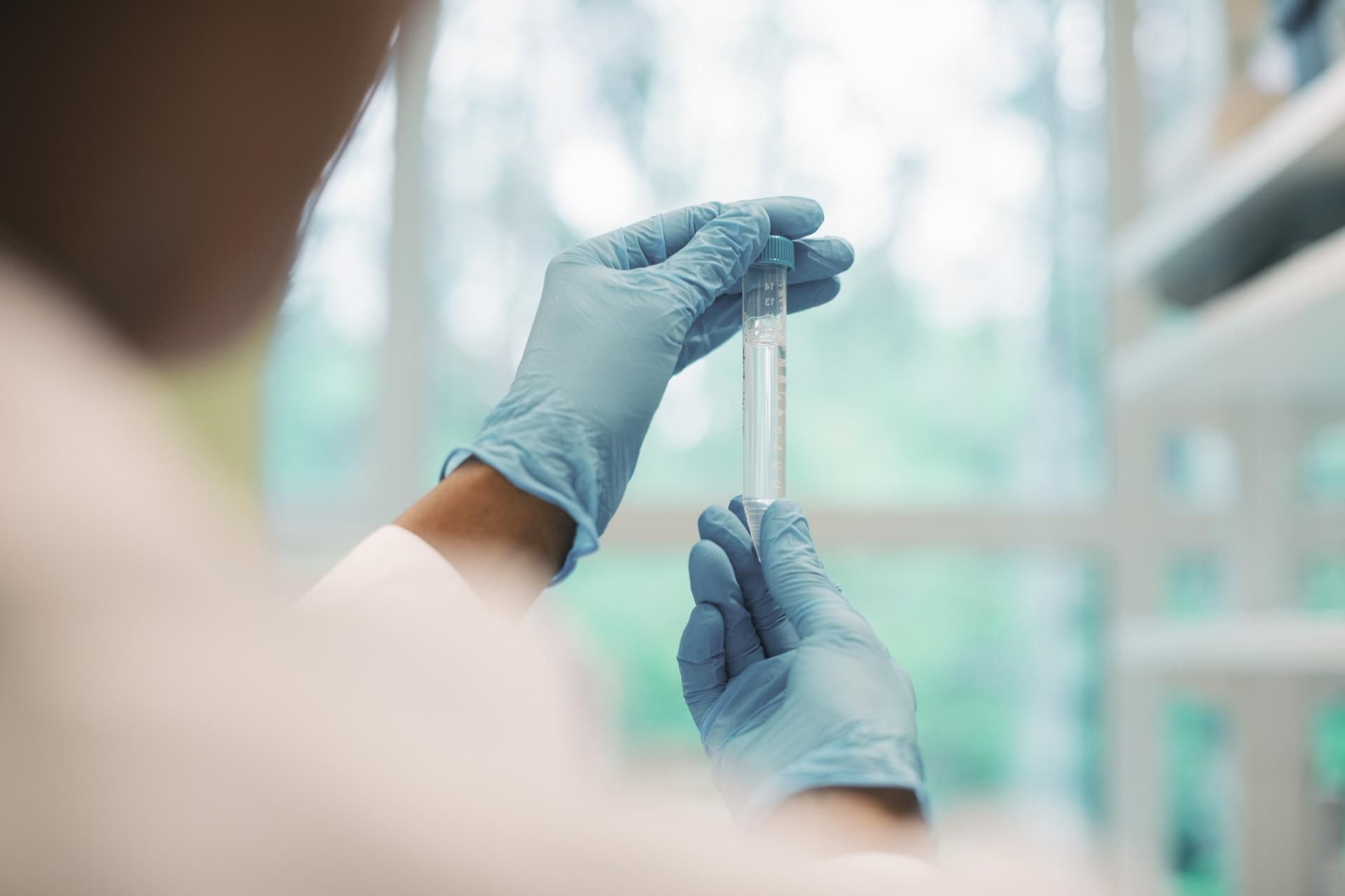 W posiewach krwi u tych pacjentów wyhodowano Klebsiella Pneumoniae