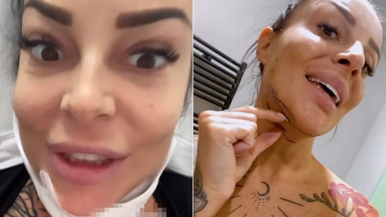 Ata Postek chwali się nowym podgardlem i pośladkami