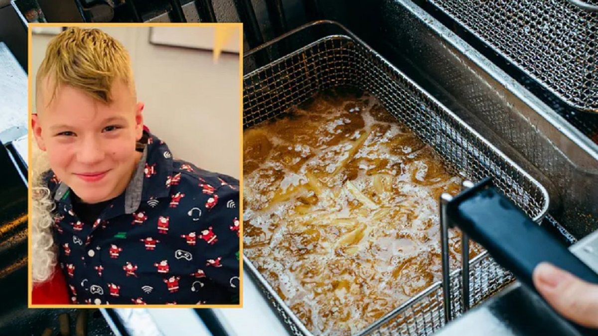 Kuba został poparzony przez rozgrzany olej. Właściciel frytkownicy ukarany. 