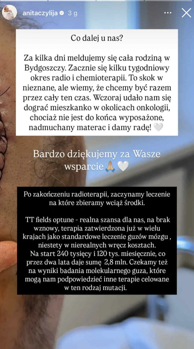 Anita Szydłowska o obecnej sytuacji