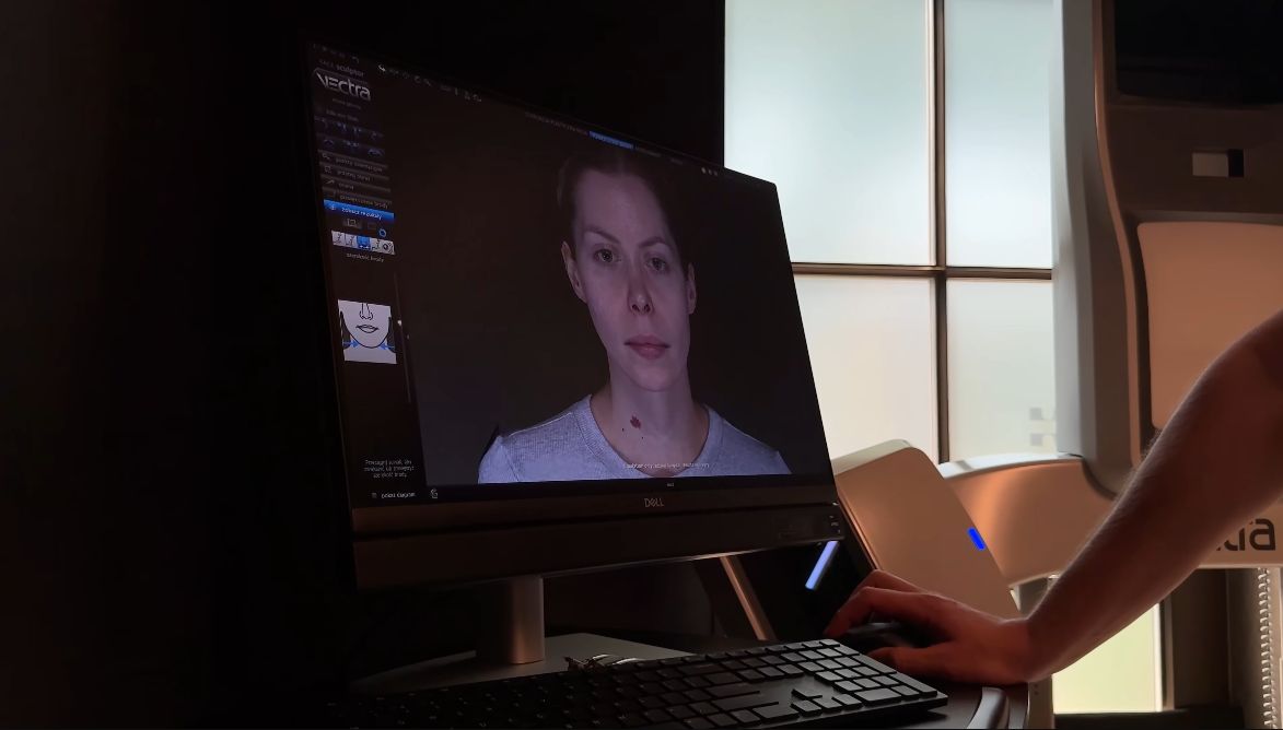 Julia von Stein podczas operacji plastycznej