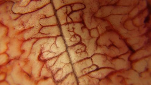 Interfejs mózg – komputer sterowany myślami gotowy do testów 1