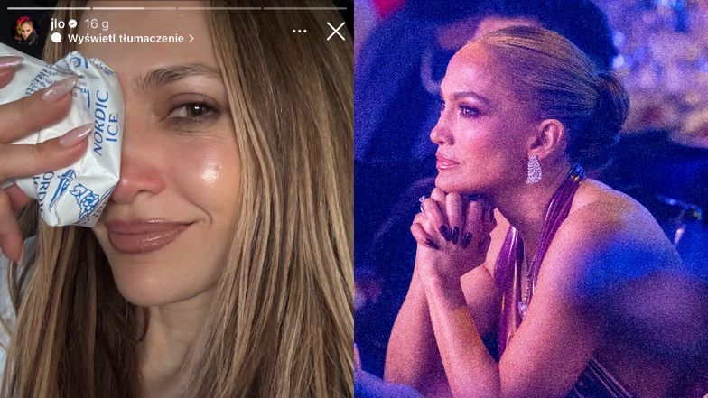 Jennifer Lopez nabawiła się kontuzji