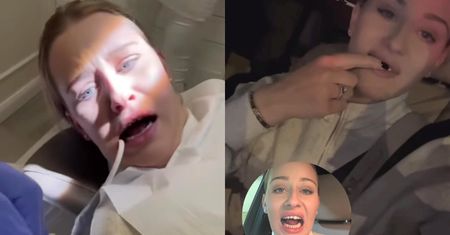 Dramat Andziaks. Youtuberka straciła ząb: "Z całej siły UGRYZŁAM WIDELEC i coś STRZELIŁO" (ZDJĘCIA)