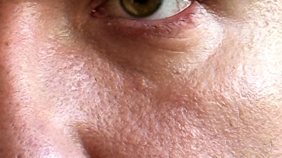 Dieta roślinna może korzystnie wpływać na skórę, ale wymaga uważnego planowania i regularnej kontroli podstawowych składników odżywczych.