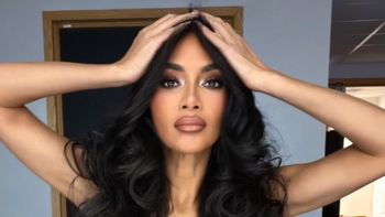 Nicole Scherzinger kusi idealnym brzuchem, a chwilę później pokazuje... POPARZONĄ NOGĘ! "To, co widzą vs. to, czego nie widzą" (FOTO)