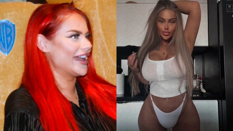 Ewel0na zachwyca się efektami ostatniej operacji plastycznej